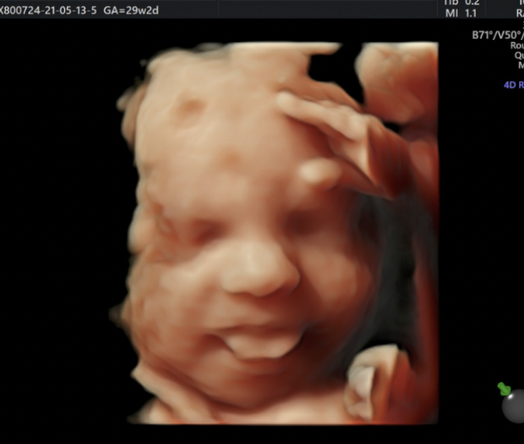 4d scan image of a baby pulling tongues from Catch A Glimpse Scanning in Liverpool